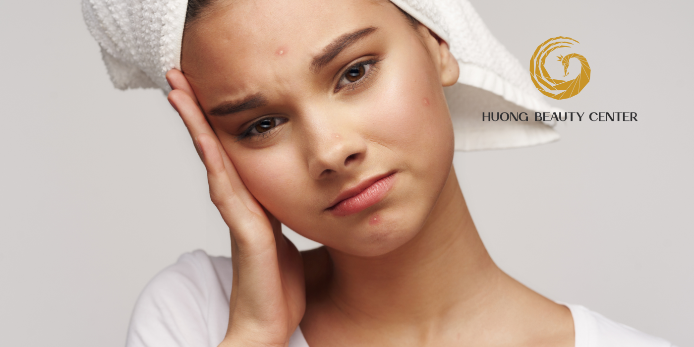 Mụn trứng cá: nỗi đau khổ của phái đẹp