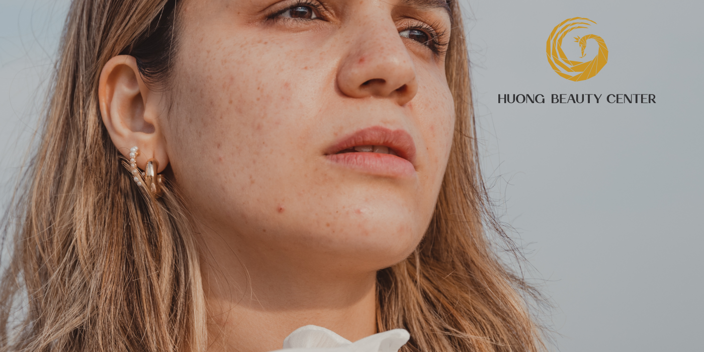 Niacinamide và những tác dụng với da